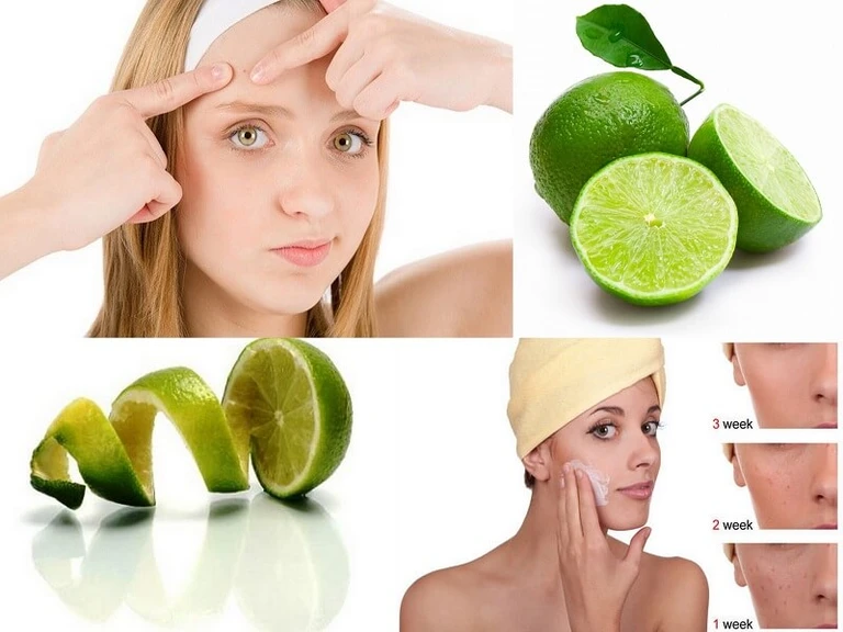 Trị Mụn Tự Nhiên Tại Nhà