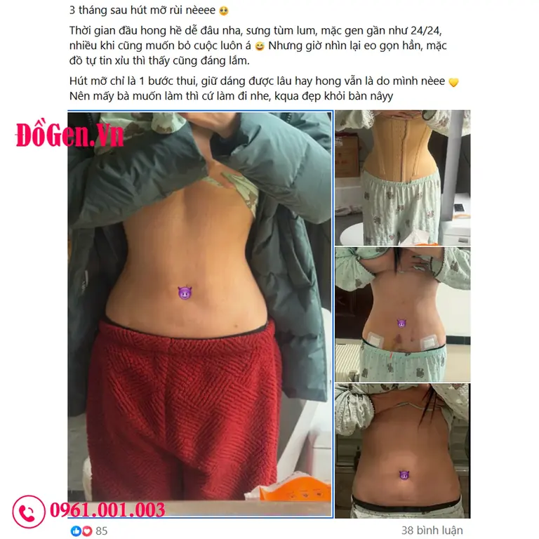 Đồ nịt bụng toàn thân sau sinh hỗ trợ phục hồi và định hình dáng