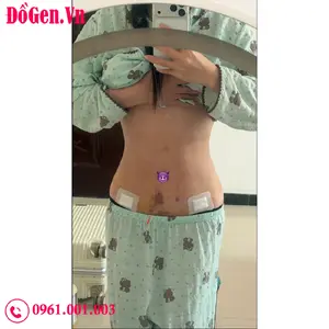 Đồ nịt toàn thân giúp giảm sưng sau hút mỡ hiệu quả