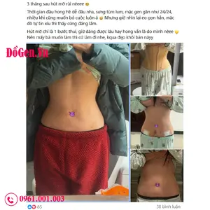 Đồ nịt bụng toàn thân sau sinh hỗ trợ phục hồi và định hình dáng