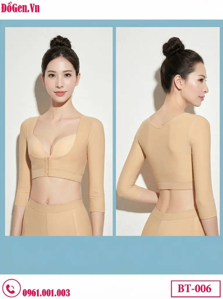 trước và sau hút mỡ bắp tay, so sánh rõ ràng