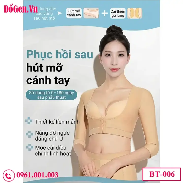 hình ảnh phục hồi sau hút mỡ bắp tay với gen nịt y khoa